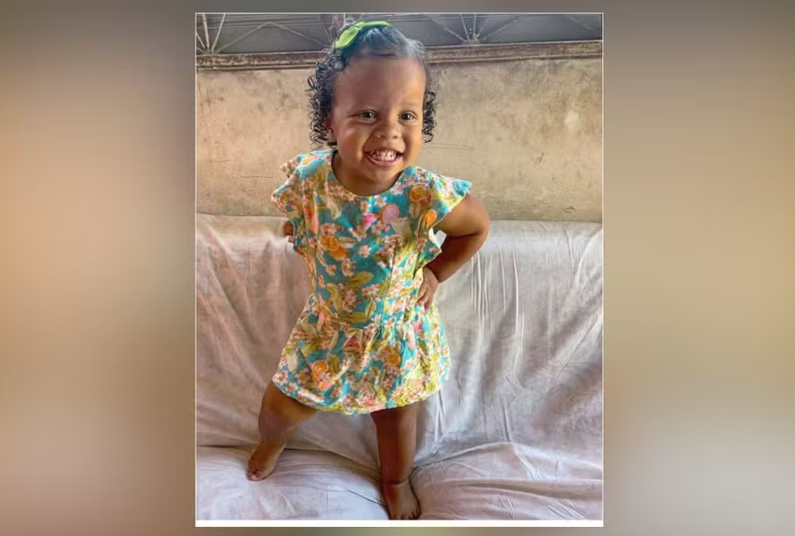 Médico sobre cirurgia de menina de 3 anos baleada na Baixada Fluminense
