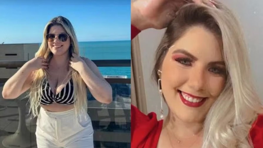 Mulher de 24 anos morre após fazer 6 cirurgias plásticas juntas