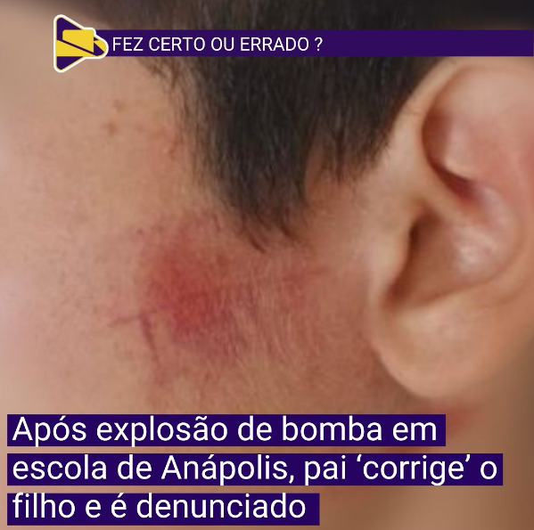 Uma denúncia de maus-tratos envolvendo um adolescente de 13 anos foi registrada na manhã da última quarta-feira (13), em um condomínio na Vila Jaiara, em Anápolis