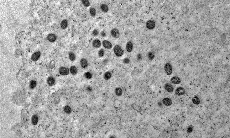 Mpox: Argentina põe navio que deixou Brasil em quarentena